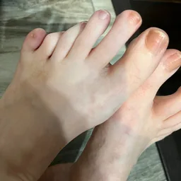 PolydactylyBri